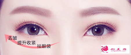 手術(shù)切除眼袋多少錢