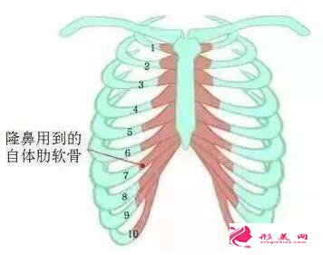 自體軟骨隆鼻的恢復(fù)時間