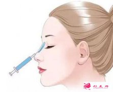 玻尿酸隆鼻效果維持時(shí)間跟用量有關(guān)嗎