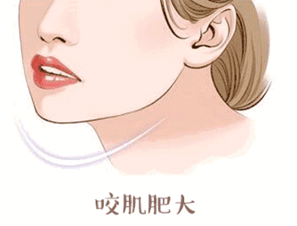 瘦臉針的效果能保持多長時(shí)間