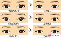 大連沙醫(yī)生整形怎么樣？價(jià)格表