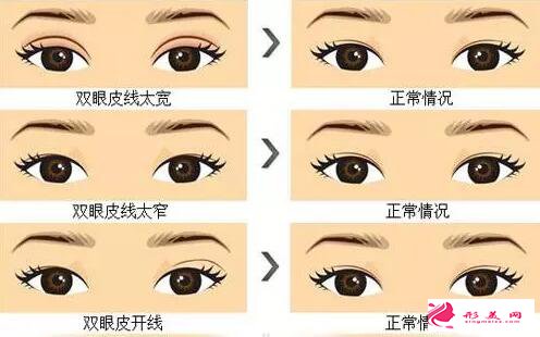 大連沙醫(yī)生整形價格表2019搶鮮價