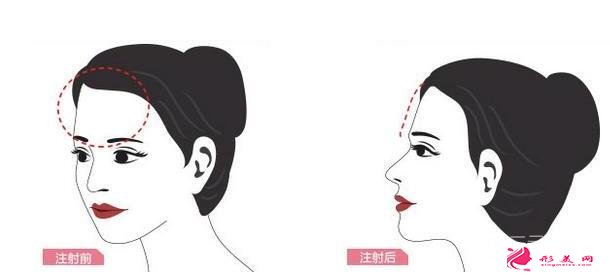 豐額頭多少錢(qián)