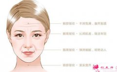 面部除皺除皺效果是怎樣的？