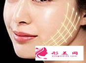 埋線提升恢復(fù)期有什么癥狀嗎