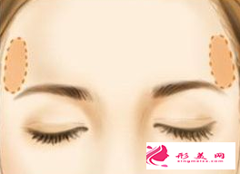 自體脂肪豐太陽(yáng)穴后要怎么保養(yǎng)