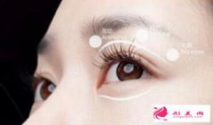 廣州做切開雙眼皮多久可以恢復(fù)