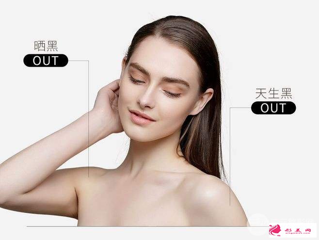 美白價格