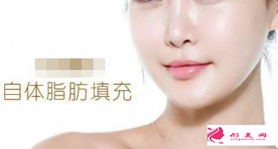 自體脂肪填充臉部能保持多久