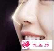 假體隆鼻失敗的主要原因