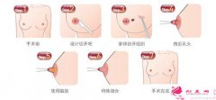 乳頭內(nèi)陷矯正手術需要多少錢？