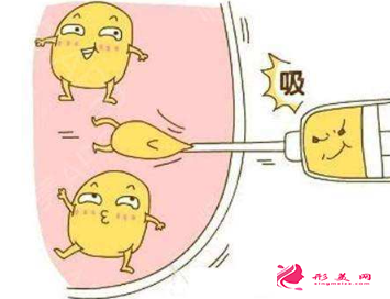 腰腹部吸脂減肥會(huì)影響健康嗎