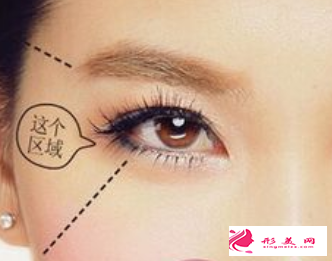 脂肪豐太陽穴后要注意什么