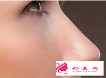 假體隆鼻會(huì)不會(huì)有感染的問(wèn)題