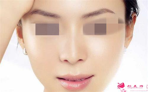 熱門(mén)項(xiàng)目假體墊鼻梁美化效果_假體墊鼻梁有幾種方式改善效果如何