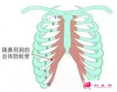 什么情況下不能做肋軟骨隆鼻嗎？
