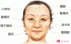 激光除皺效果能保持多少年？