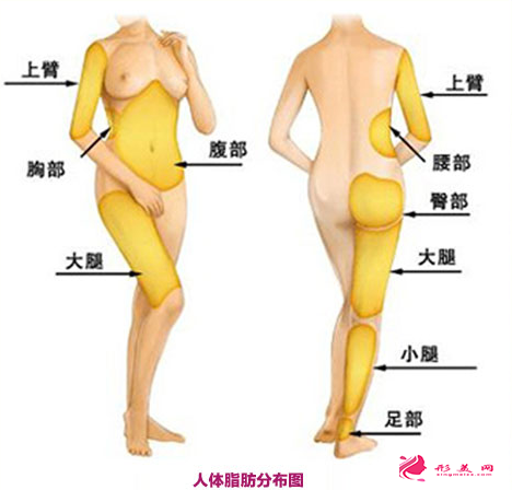 吸脂減肥后要痛多久