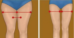 吸脂瘦大腿腫脹期是多久？多久能看到效果？