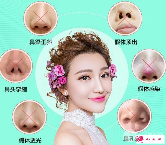 隆鼻失敗怎么辦？鼻修復(fù)手術(shù)是怎么做的？