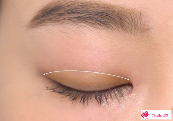 做雙眼皮手術(shù)要開眼角嗎
