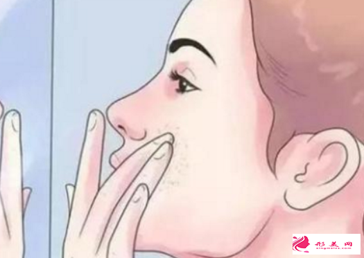 激光祛斑皮膚反黑要怎么辦