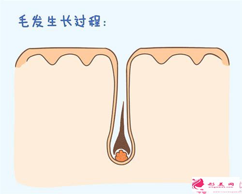 腋下冰點(diǎn)脫毛價(jià)格多少