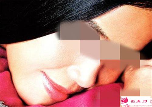 唇部整形手術(shù)失敗過(guò)后如何做