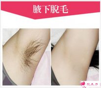 超冰和冰點(diǎn)脫毛的區(qū)別