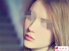 內(nèi)切縮鼻翼怎么保養(yǎng)比較好？