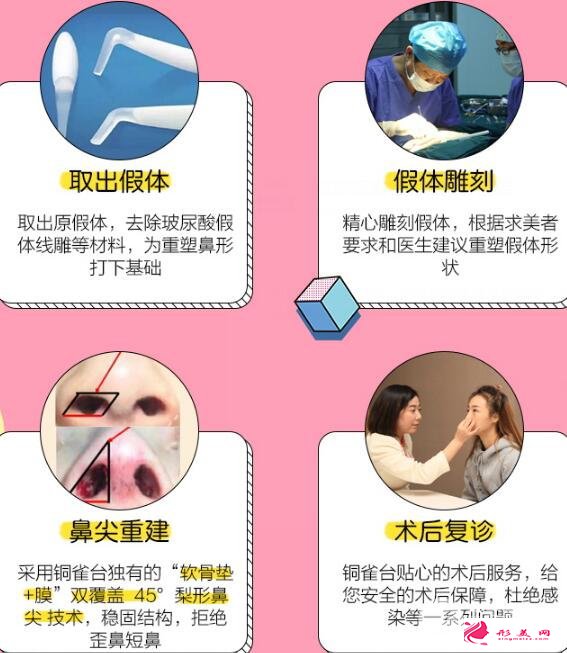 隆鼻失敗怎么辦？別慌，這里有自救指南！