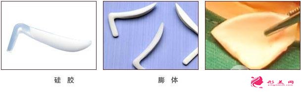 全自體軟骨隆鼻