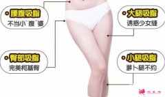 吸脂瘦大腿腫脹期是多久？教你如何護(hù)理