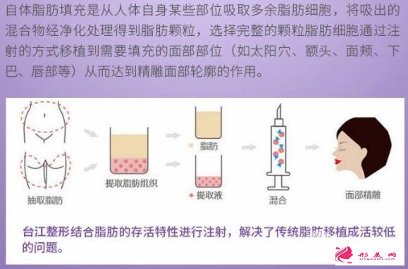 全面部自體脂肪填充效果：美圖放送~