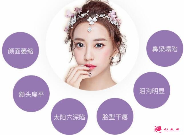 全面部自體脂肪填充效果：美圖放送~