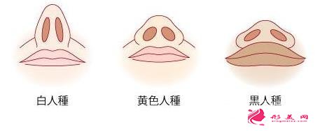 鼻頭縮小術前注意事項