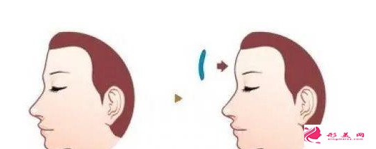 北京額部填充的價(jià)格是多少