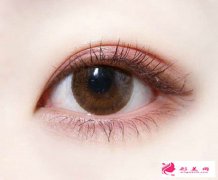 開眼角手術(shù)幫你告別“瞇瞇眼”