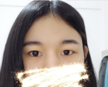 上海九院開雙眼皮誰(shuí)做的好？楊群案列分享