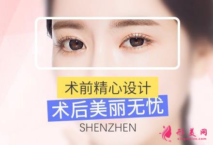 現(xiàn)在割雙眼皮價(jià)位表多少錢上海