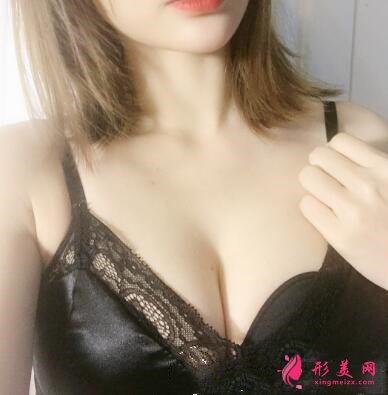 手術(shù)后三個月