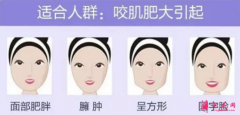 瘦臉針是怎么打的？