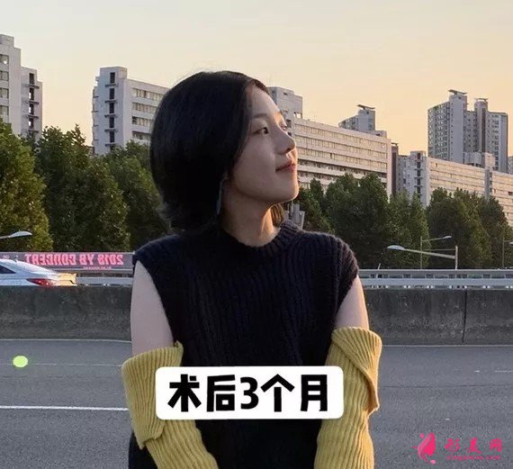 李信鋒做鼻子怎么樣？看看案例圖就知道醫(yī)生技術(shù)了