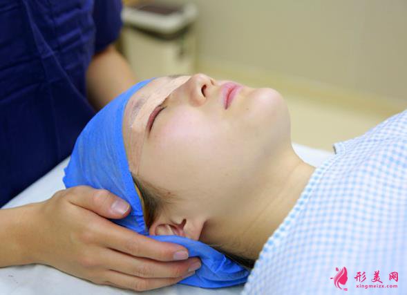 深圳美加美醫(yī)療美容雙眼皮術(shù)后