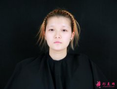 成都米蘭柏羽醫(yī)院做雙眼皮怎么樣?雙眼皮案例你不得不看