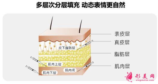 大腿抽脂填充臉部手術(shù)風(fēng)險有哪些？