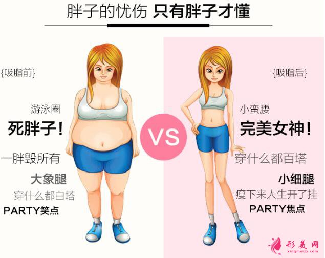 各部位吸脂手術(shù)的價(jià)格分別是多少呢?
