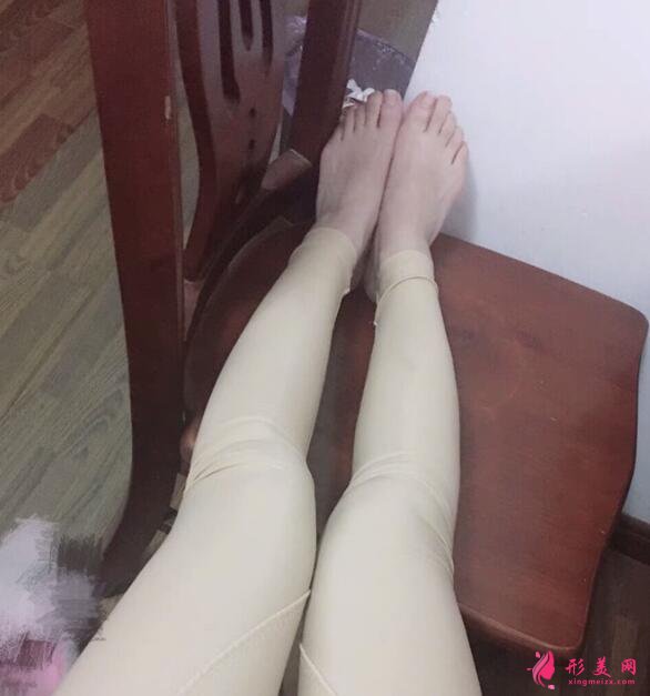 手術(shù)一周后
