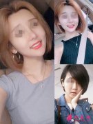 沈陽協(xié)和整形美容醫(yī)院隆鼻怎么樣？案例+價(jià)格表分享