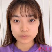 北京八大處整形外科醫(yī)院做磨下頜角怎么樣？下頜角案例分享